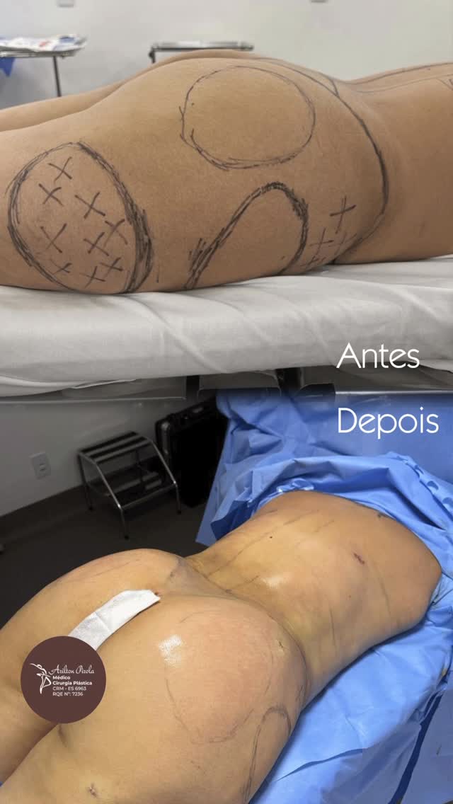 Antes e depois — vídeo 3