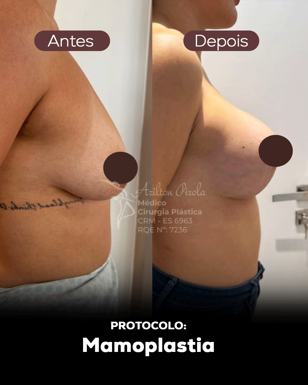 Antes e depois 1